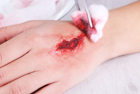 Injured Hand With Blood On Table In Hospital